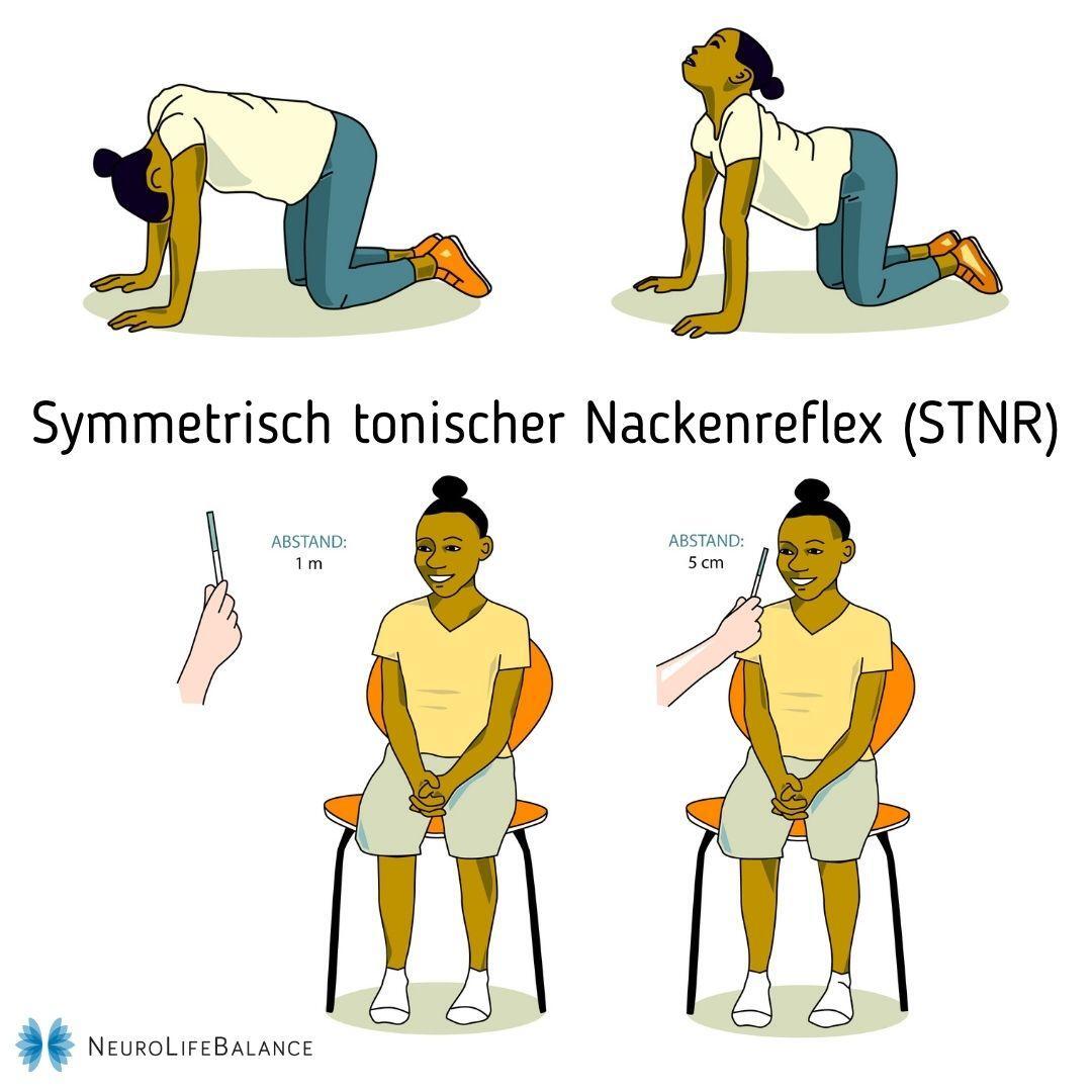 Der Symmetrisch Tonische Nackenreflex (STNR)